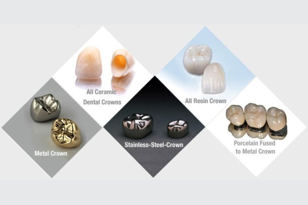 Dental Crowns: Which Is the Right Type for You?