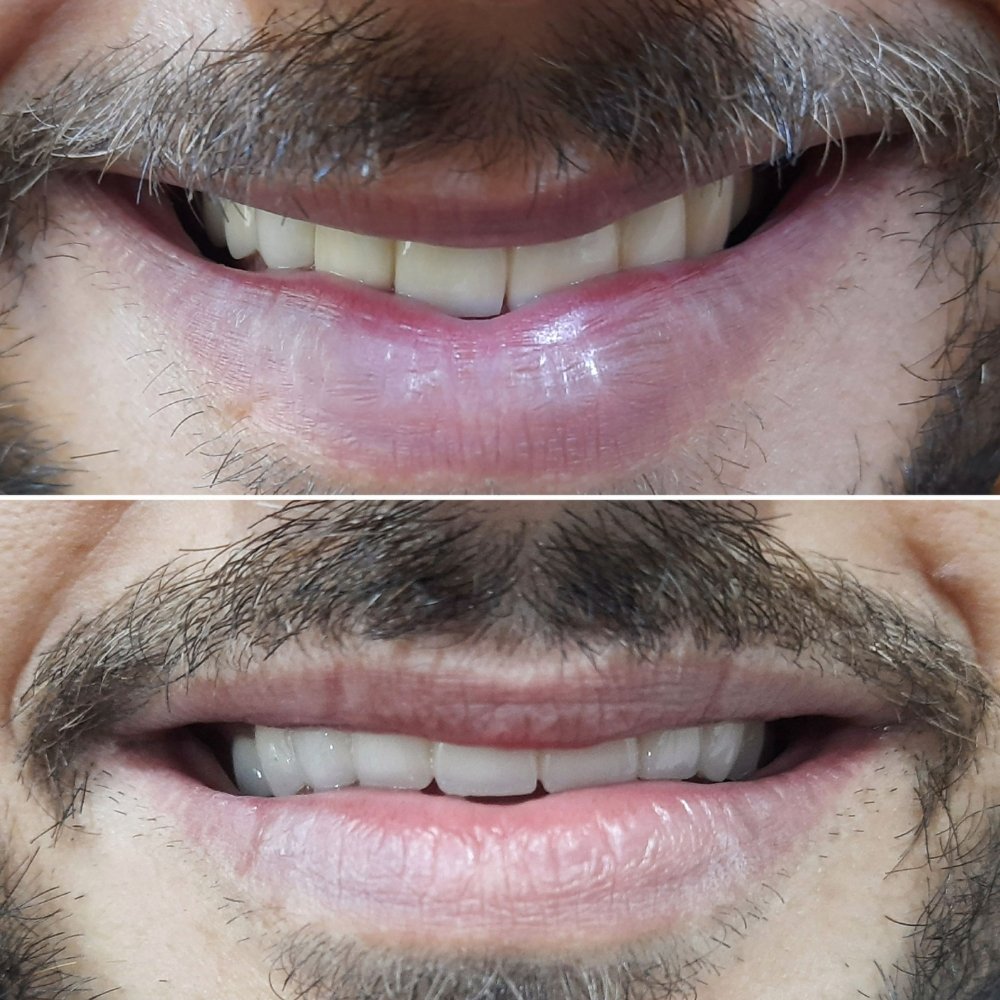 dental_case_study (10)