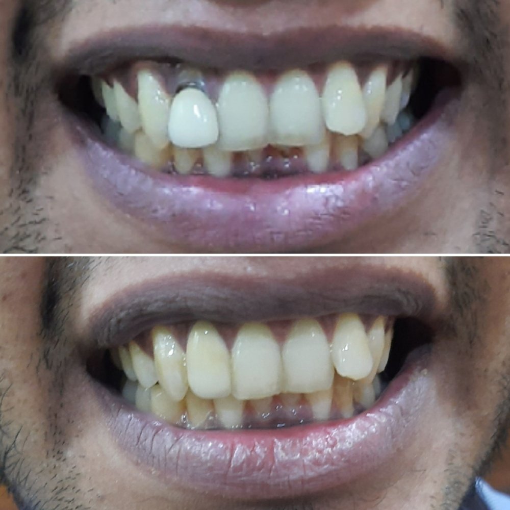 dental_case_study (11)