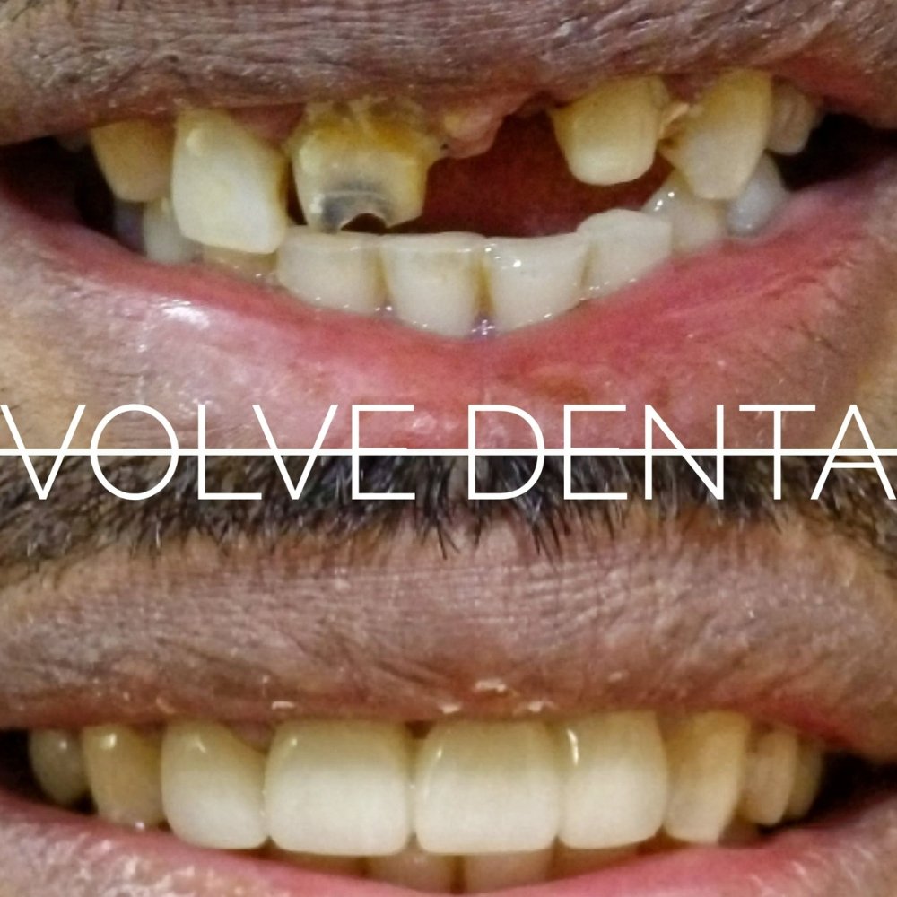 dental_case_study (12)