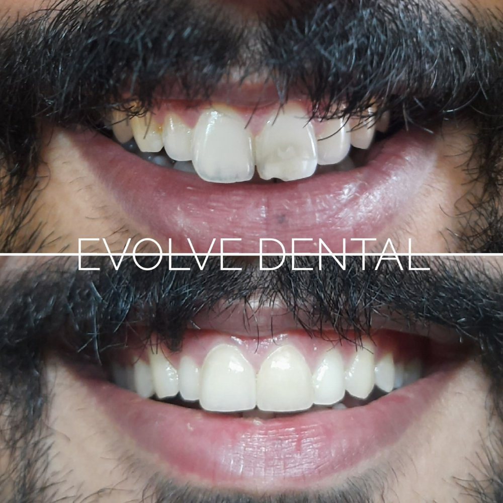 dental_case_study (13)
