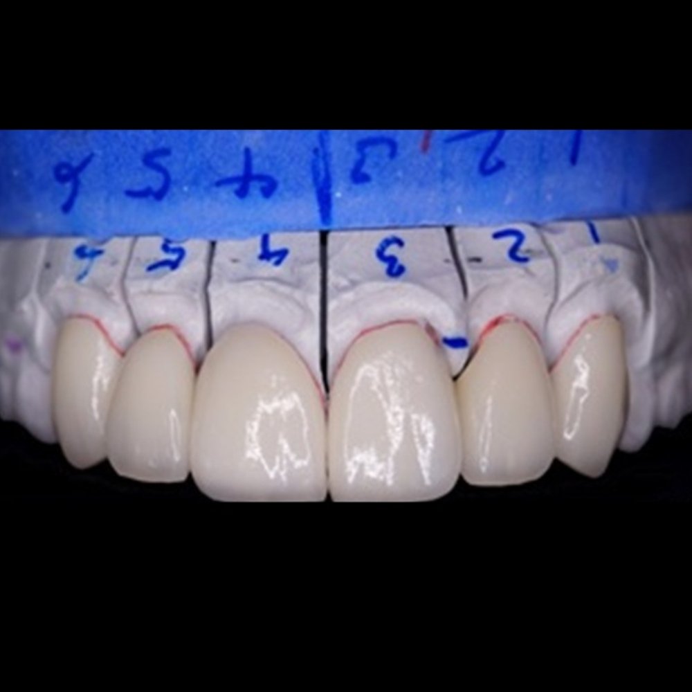 dental_case_study (14)
