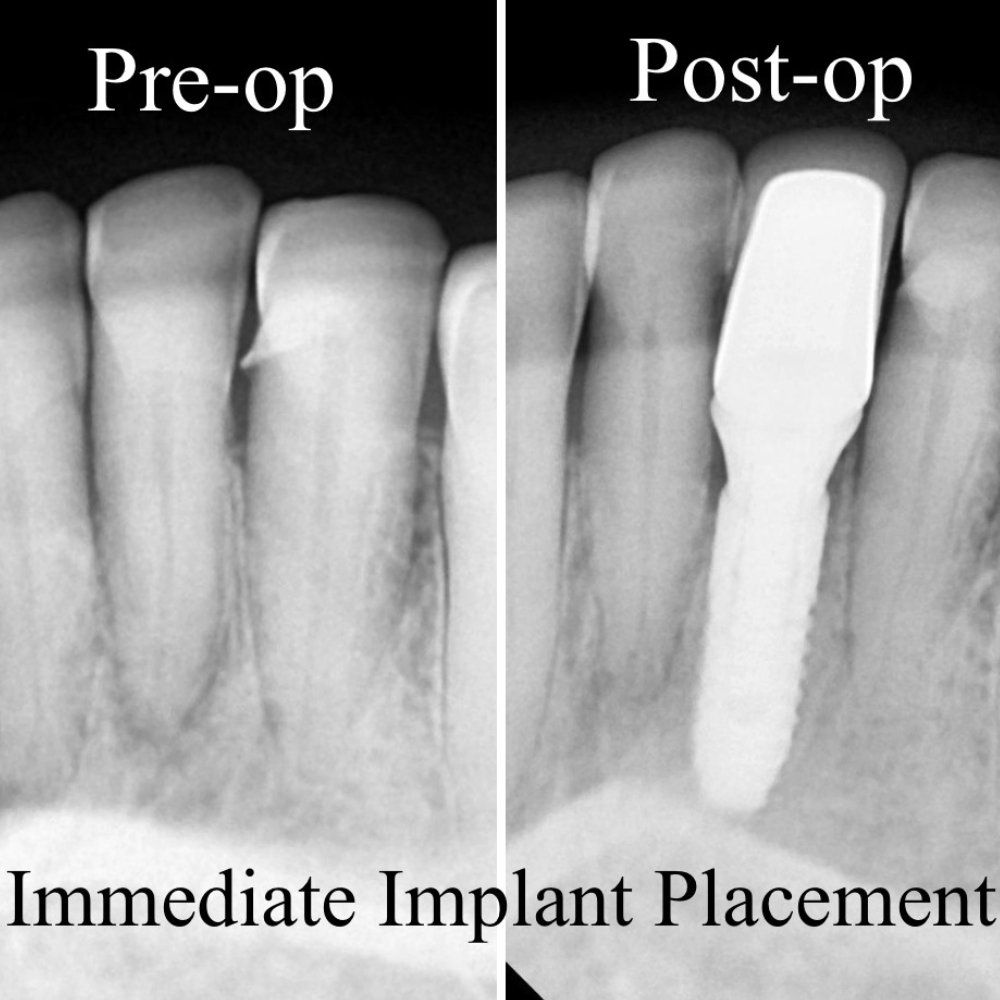 dental_case_study (15)