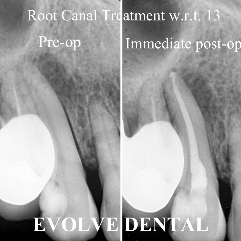 dental_case_study (16)