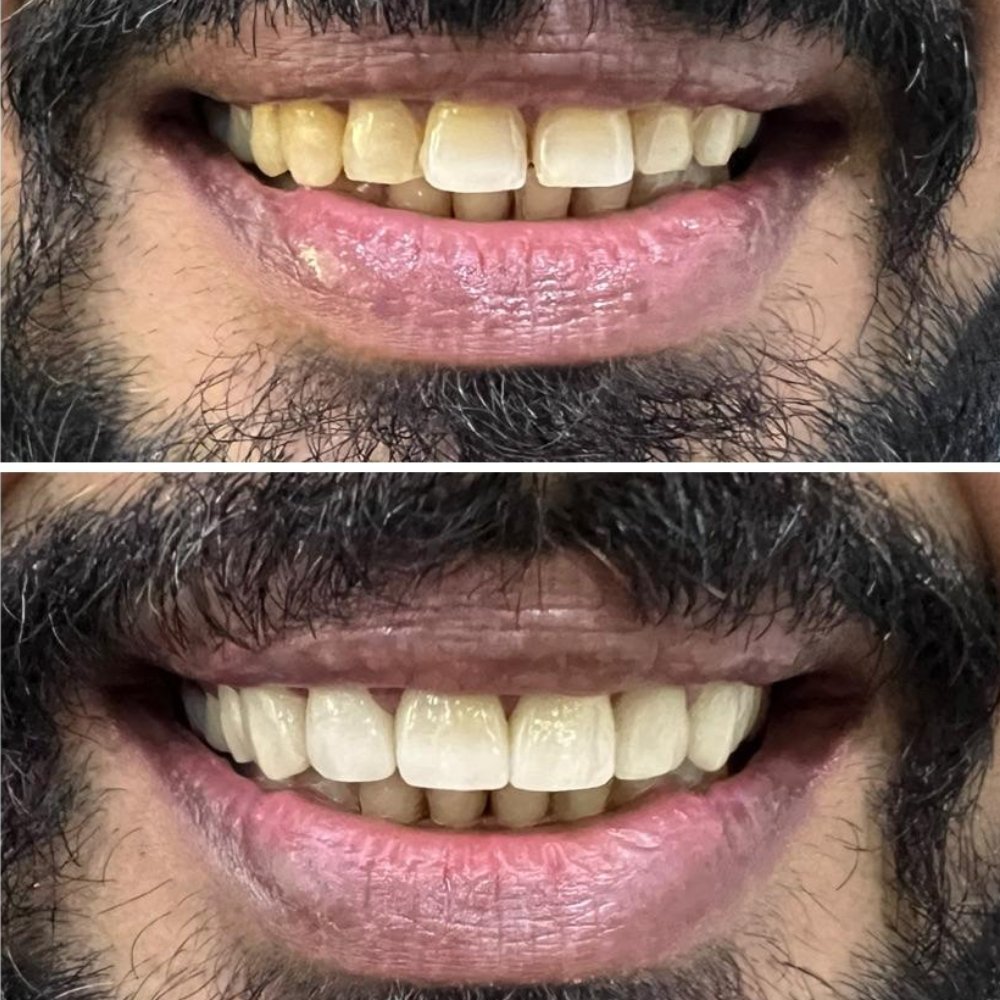 dental_case_study (2)