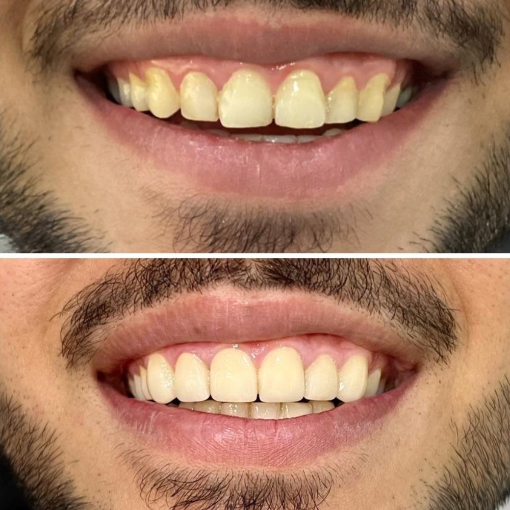 dental_case_study (4)