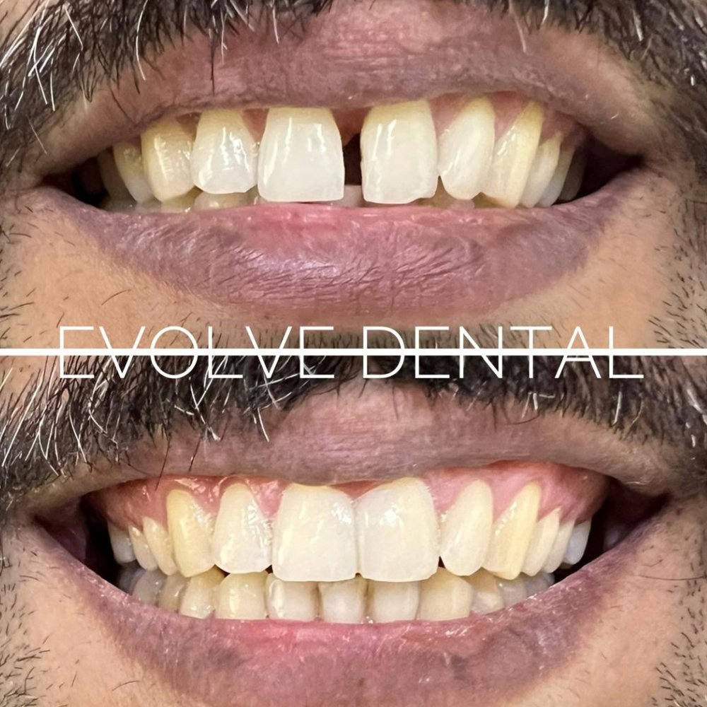 dental_case_study (5)