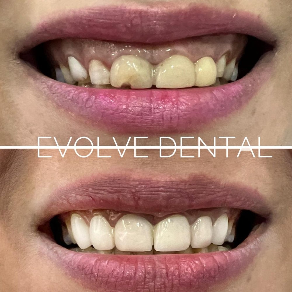 dental_case_study (6)