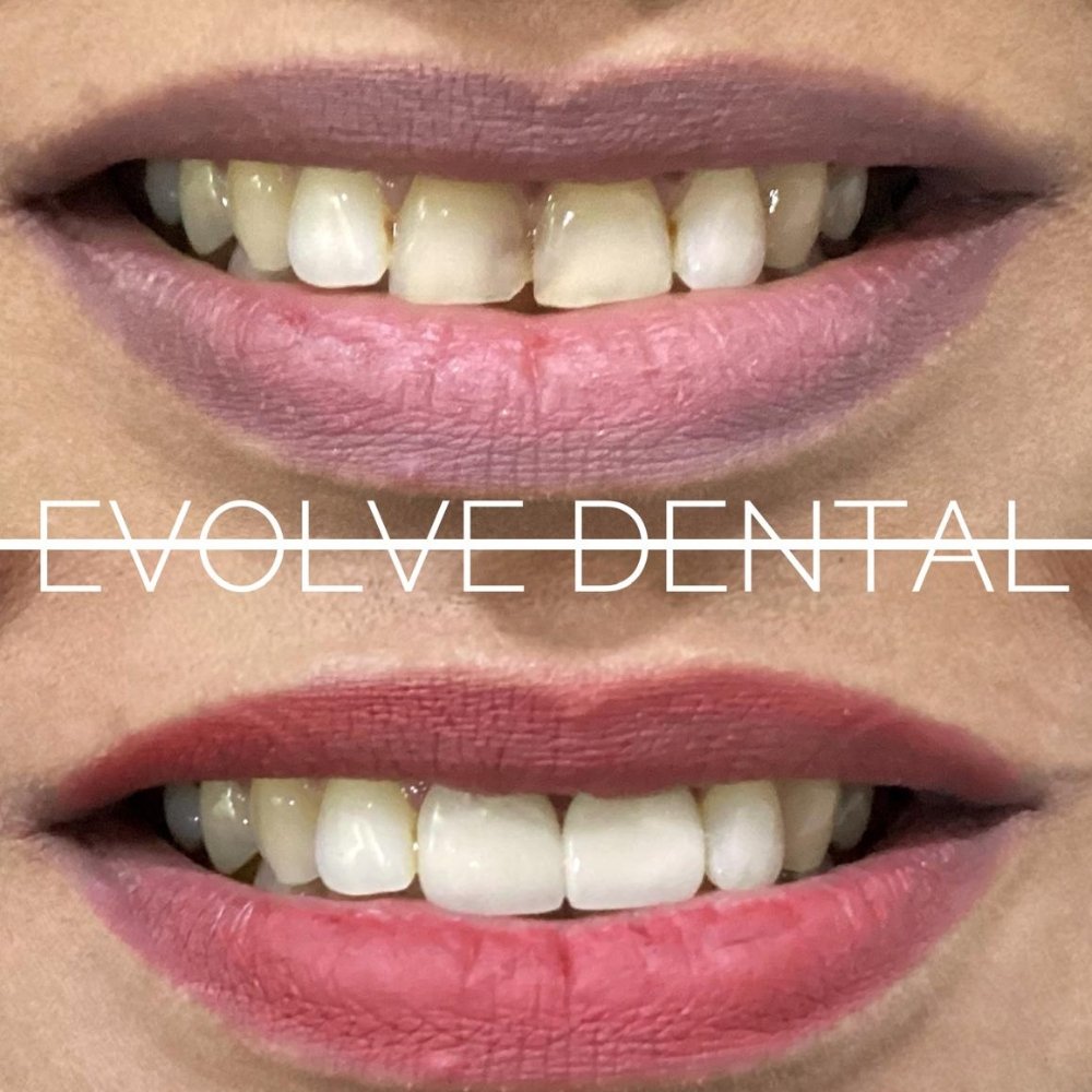 dental_case_study (8)