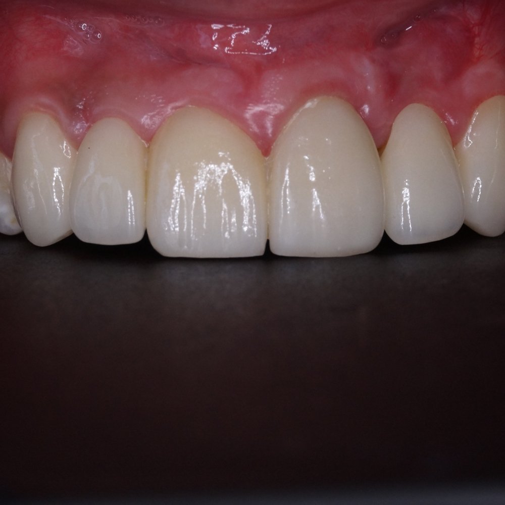dental_case_study (9)