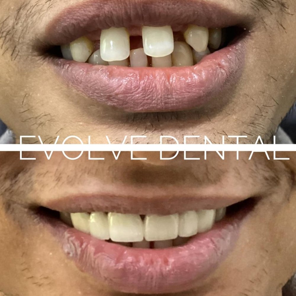dental_case_study